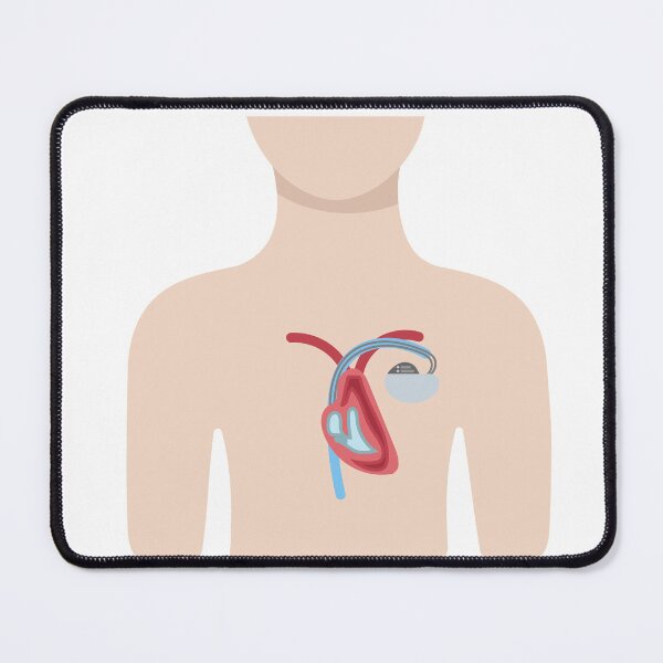 Item preview, Upper Body with Pacemaker Illustration designed and sold by EmeraldeaArt.