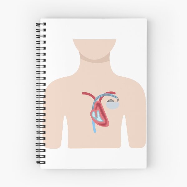 Item preview, Upper Body with Pacemaker Illustration designed and sold by EmeraldeaArt.