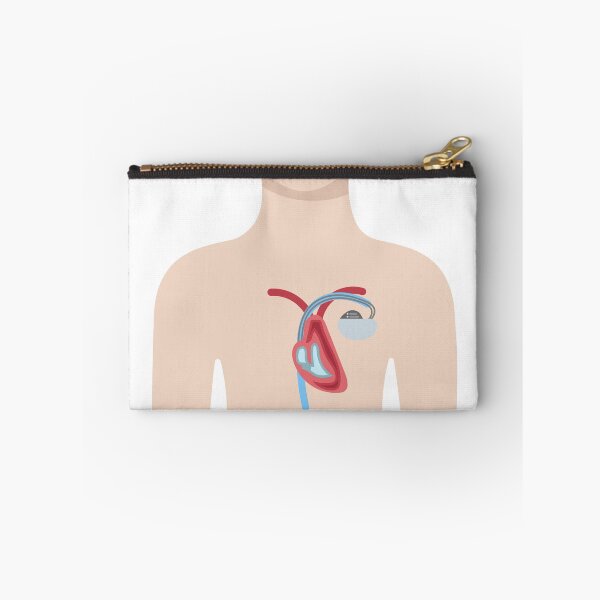 Item preview, Upper Body with Pacemaker Illustration designed and sold by EmeraldeaArt.