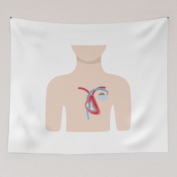 Item preview, Upper Body with Pacemaker Illustration designed and sold by EmeraldeaArt.