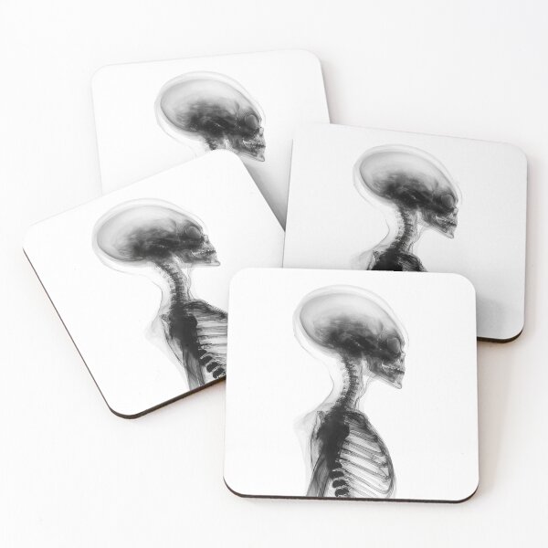 Item preview, X-ray of an alien designed and sold by Brendon987.