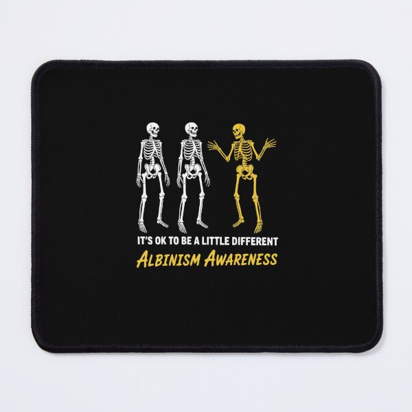 Item preview, Albinism Awareness It's Ok To Be A Little Different Funny designed and sold by FranzFriesen.