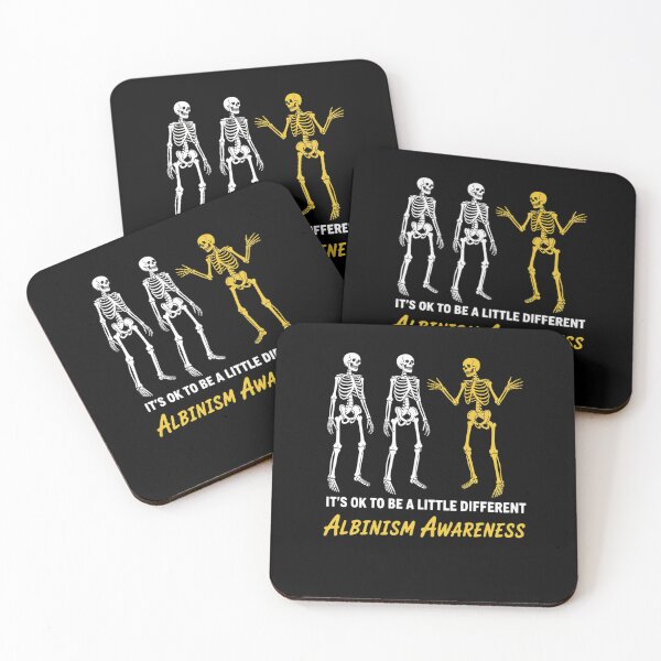 Item preview, Albinism Awareness It's Ok To Be A Little Different Funny designed and sold by FranzFriesen.