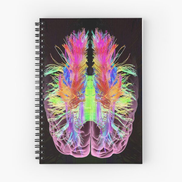 Item preview, White Matter Fibres And Brain designed and sold by BritishYank.
