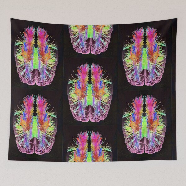 Item preview, White Matter Fibres And Brain designed and sold by BritishYank.
