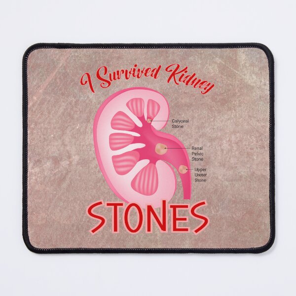 Item preview,  I Survived Kidney Stones designed and sold by MysticOzzy.