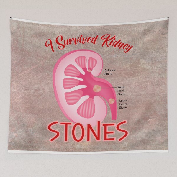 Item preview,  I Survived Kidney Stones designed and sold by MysticOzzy.