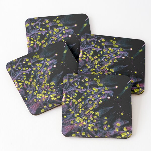 Item preview, Spring designed and sold by MicroLife-DSG.
