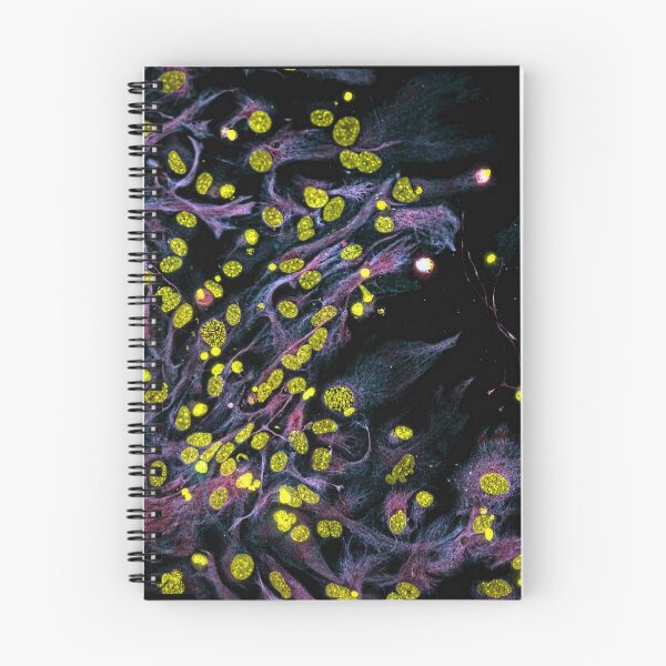 Item preview, Spring designed and sold by MicroLife-DSG.