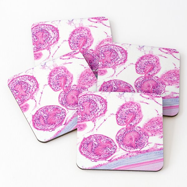 Item preview, Echinococcus granulosus designed and sold by Bobbi Pritt.