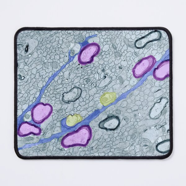 Item preview, Development designed and sold by MicroLife-DSG.