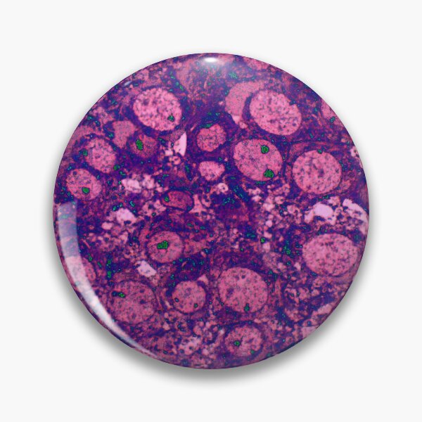 Item preview, Neuronal Collection: Grapes designed and sold by MicroLife-DSG.