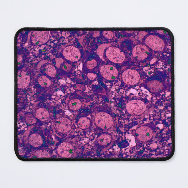 Item preview, Neuronal Collection: Grapes designed and sold by MicroLife-DSG.