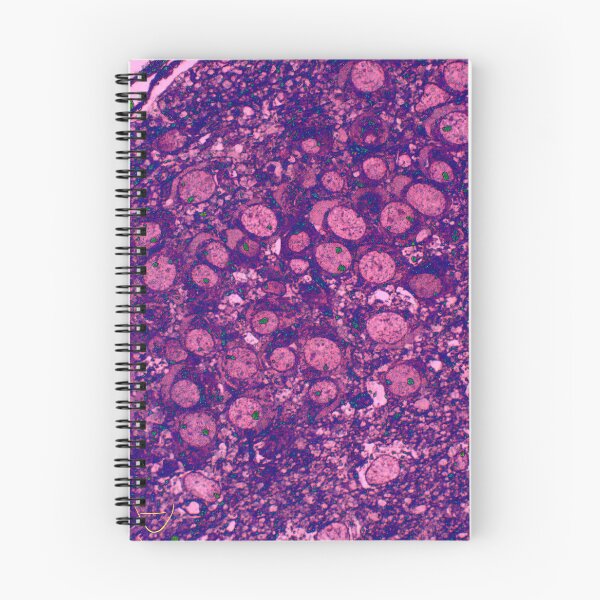 Item preview, Neuronal Collection: Grapes designed and sold by MicroLife-DSG.