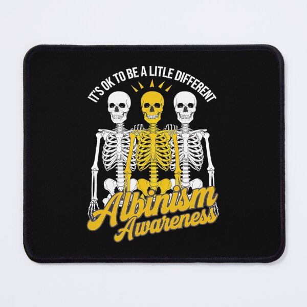Item preview, Albinism Awareness It's Ok To Be A Little Different Funny  designed and sold by SIGORDESIGN.