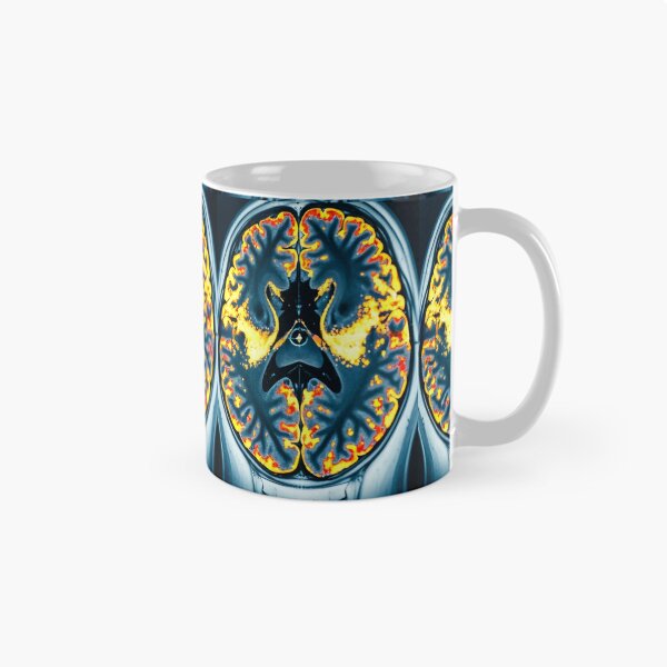 Item preview, Brain inside  designed and sold by AwesomeDigiShop.