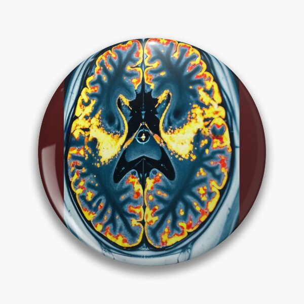 Item preview, Brain inside  designed and sold by AwesomeDigiShop.