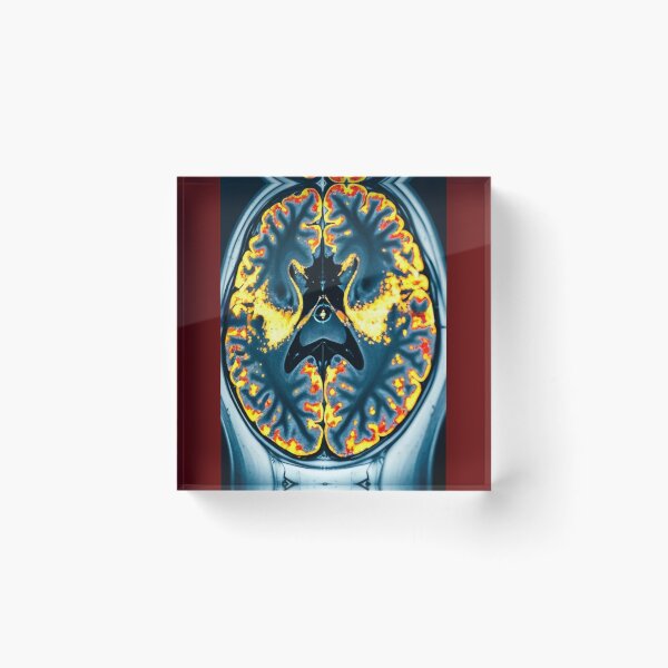 Item preview, Brain inside  designed and sold by AwesomeDigiShop.