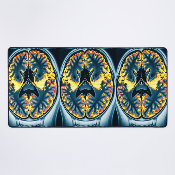 Item preview, Brain inside  designed and sold by AwesomeDigiShop.