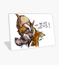 Pain Goes Here Laptop Skin