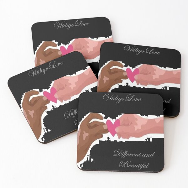 Item preview, Vitiligo Love designed and sold by LCReVamped.