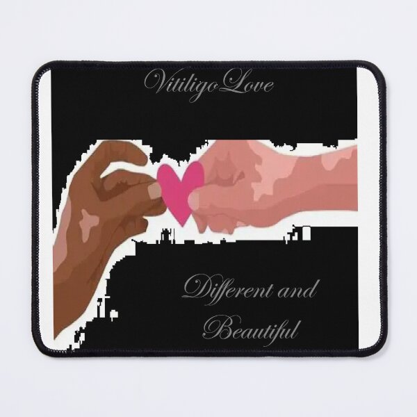 Item preview, Vitiligo Love designed and sold by LCReVamped.