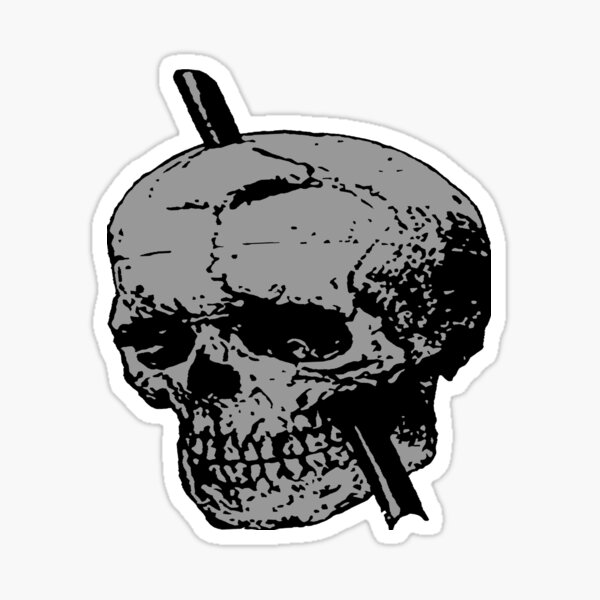 Grey Skull Of Phineas Gage With Tamping Iron Sticker For Sale By