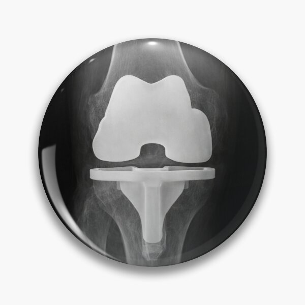 Item preview, Congrats On Your Knee Replacement designed and sold by drmekcrafts.
