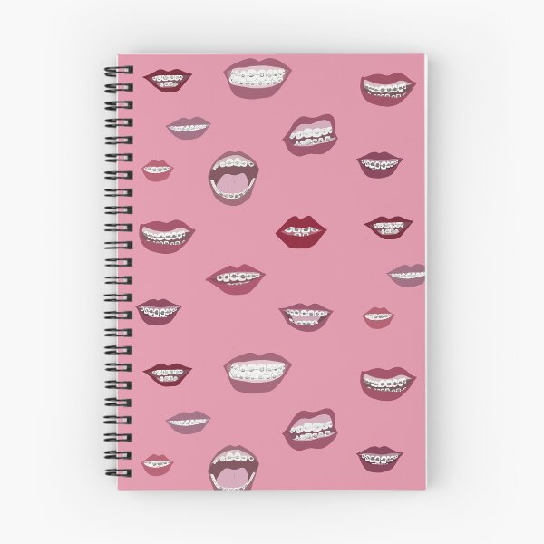 Item preview, Braces designed and sold by Amy Hadden.