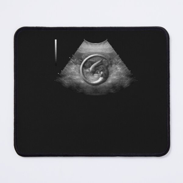 Item preview, Alien on Board - Ultrasound designed and sold by Asifhasansabbir.