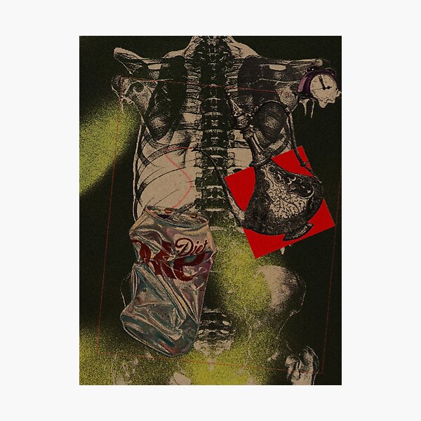 Item preview, Fragile Body – Dark Surreal Skeleton Collage Artwork designed and sold by Kr1motion.