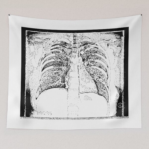 Item preview, Chest X-Ray designed and sold by The Stippler Process.