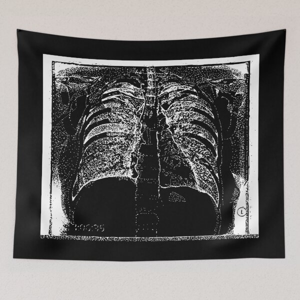 Item preview, Chest X-Ray - Light Lines designed and sold by The Stippler Process.