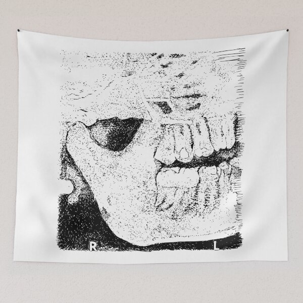 Item preview, Sweet Tooth X-Ray designed and sold by The Stippler Process.