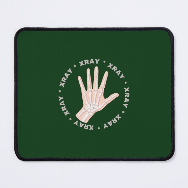 Item preview, Xray Broken hand  designed and sold by Rad and Reading.