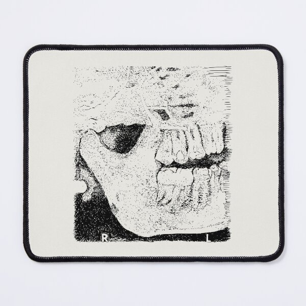 Item preview, Sweet Tooth X-Ray - (#F0EEE9) designed and sold by The Stippler Process.