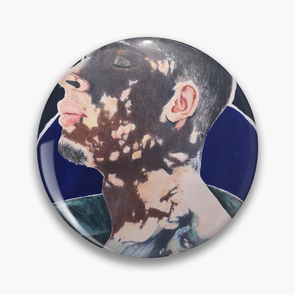 Item preview, Vitiligo Portrait – Black Man with Skin Condition designed and sold by BillRobert.