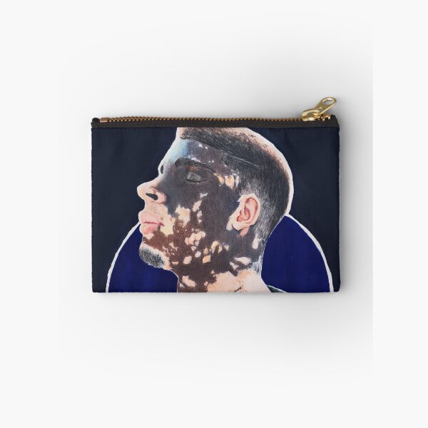 Item preview, Vitiligo Portrait – Black Man with Skin Condition designed and sold by BillRobert.