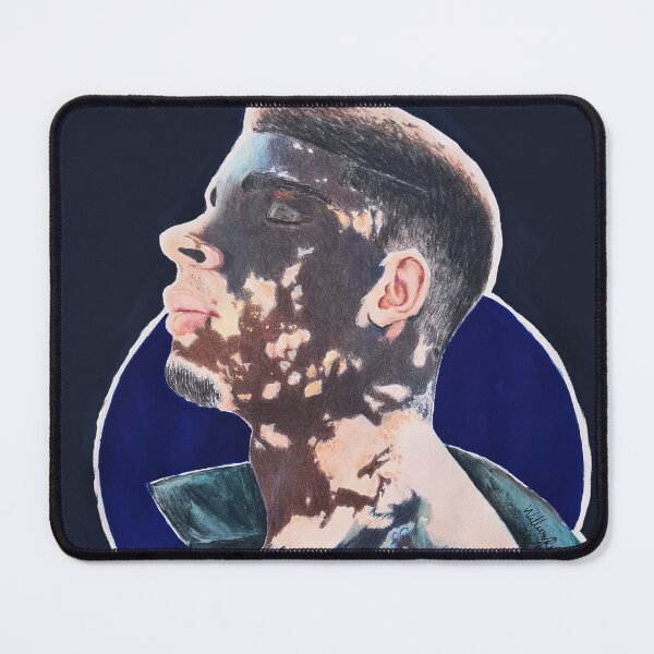 Item preview, Vitiligo Portrait – Black Man with Skin Condition designed and sold by BillRobert.