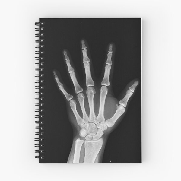 Item preview, Skeletal hand designed and sold by sycho25.