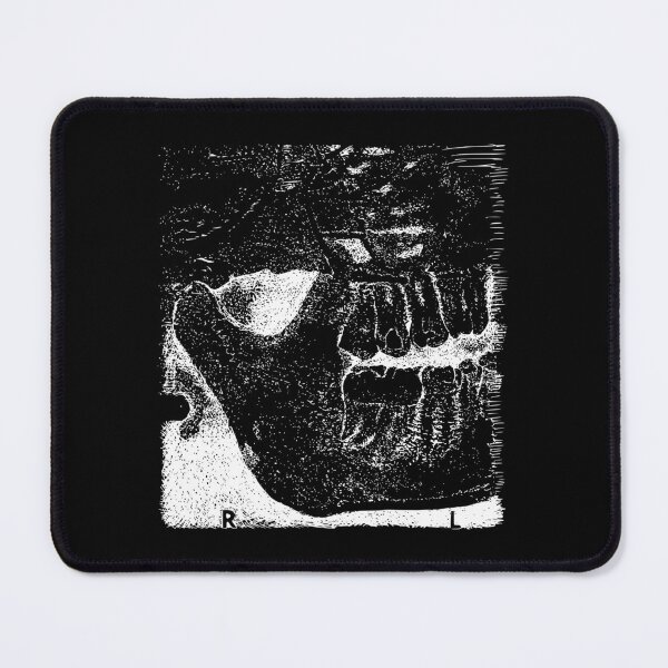 Item preview, Sweet Tooth X-Ray - Light Lines designed and sold by The Stippler Process.