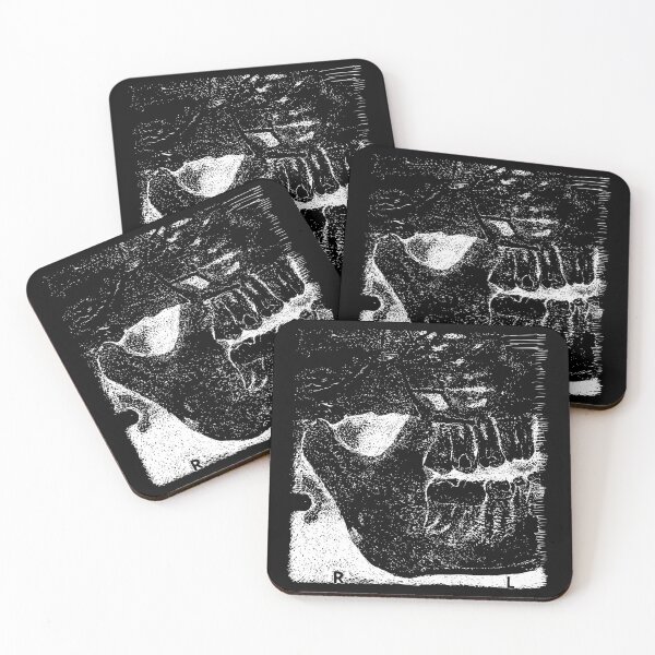 Item preview, Sweet Tooth X-Ray - Light Lines designed and sold by The Stippler Process.