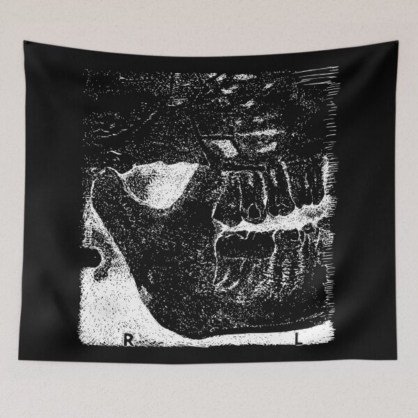 Item preview, Sweet Tooth X-Ray - Light Lines designed and sold by The Stippler Process.