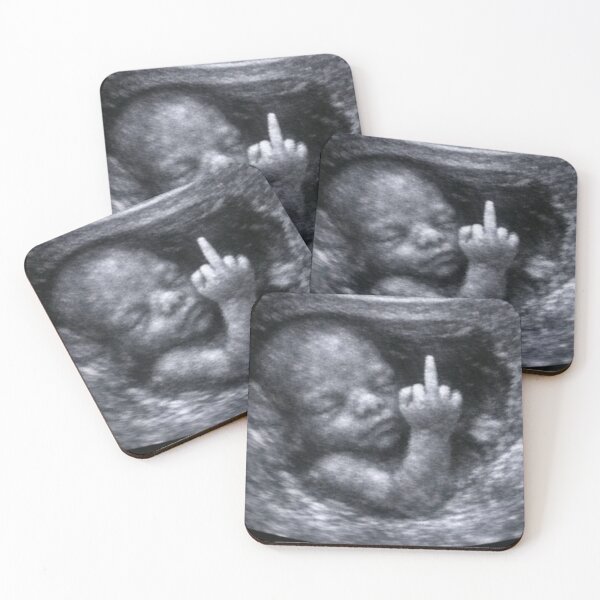Item preview, Fetus designed and sold by Kikibou.