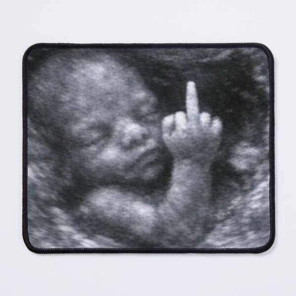 Item preview, Fetus designed and sold by Kikibou.