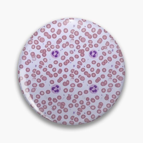 Item preview, Blood smear under the microscope - Hematology art designed and sold by JohnWar.
