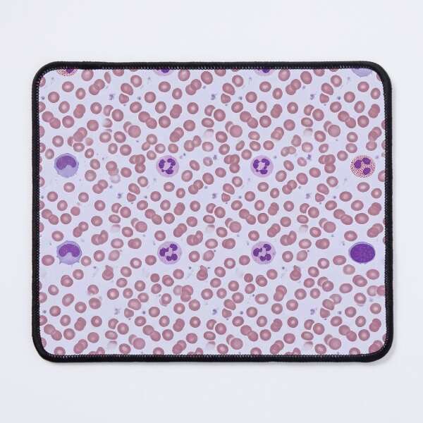Item preview, Blood smear under the microscope - Hematology art designed and sold by JohnWar.