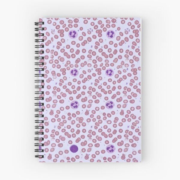 Item preview, Blood smear under the microscope - Hematology art designed and sold by JohnWar.