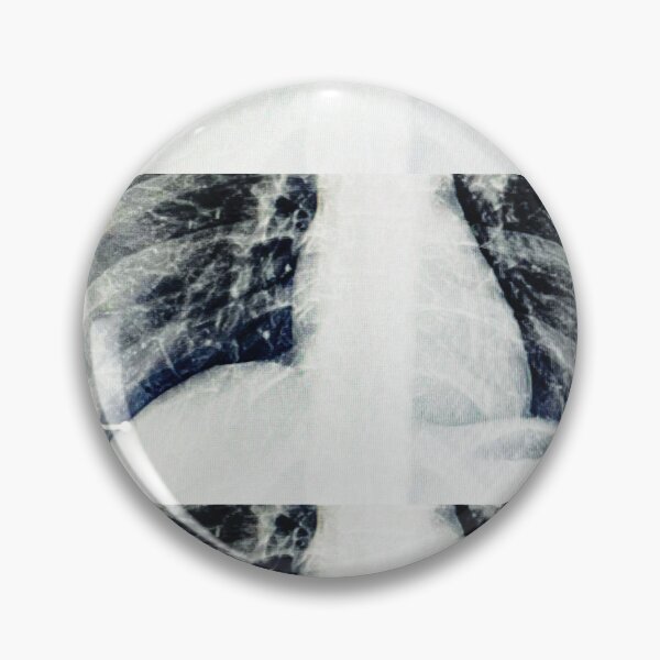 Item preview, Pneumonia nipples  designed and sold by ZelSells.