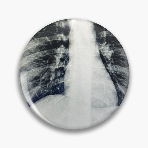 Item preview, Pneumonia nipple X-ray designed and sold by ZelSells.